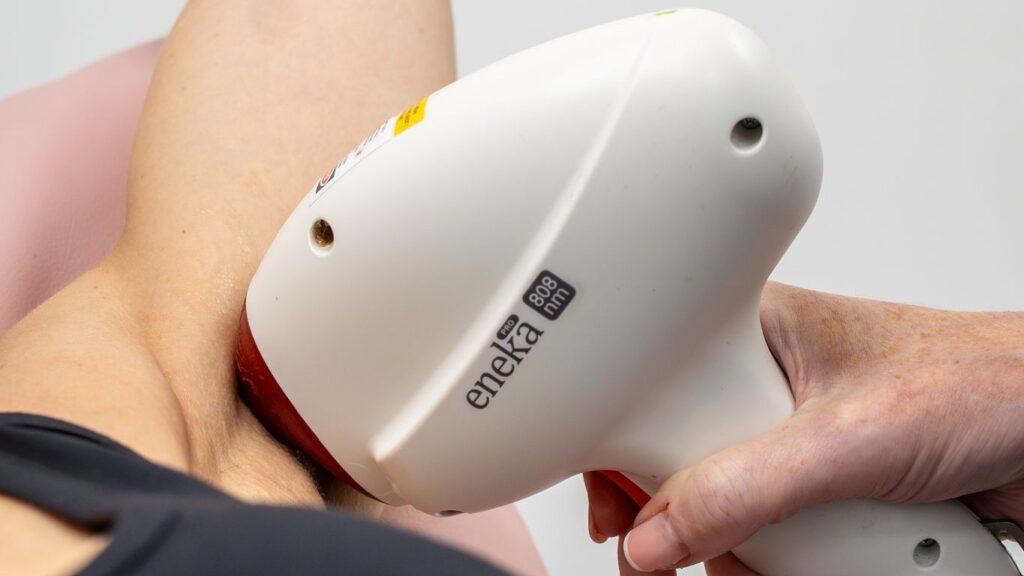 Laser hair removal device being used on an underarm