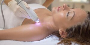 Middle-aged woman receiving laser hair removal underarm in spa clinic